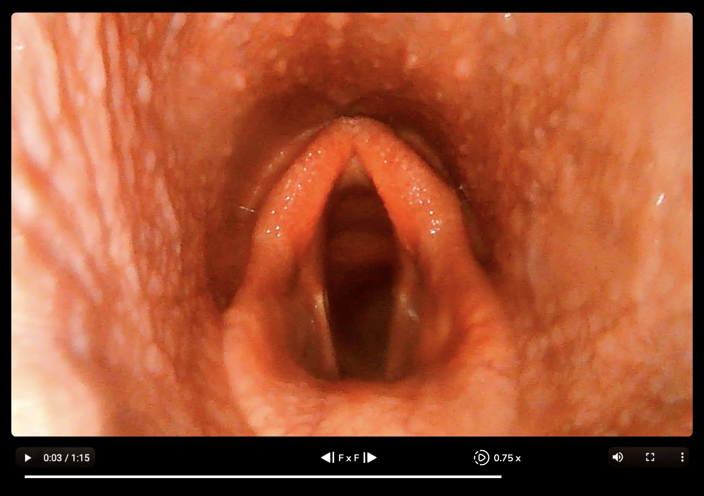 Scope video player frame