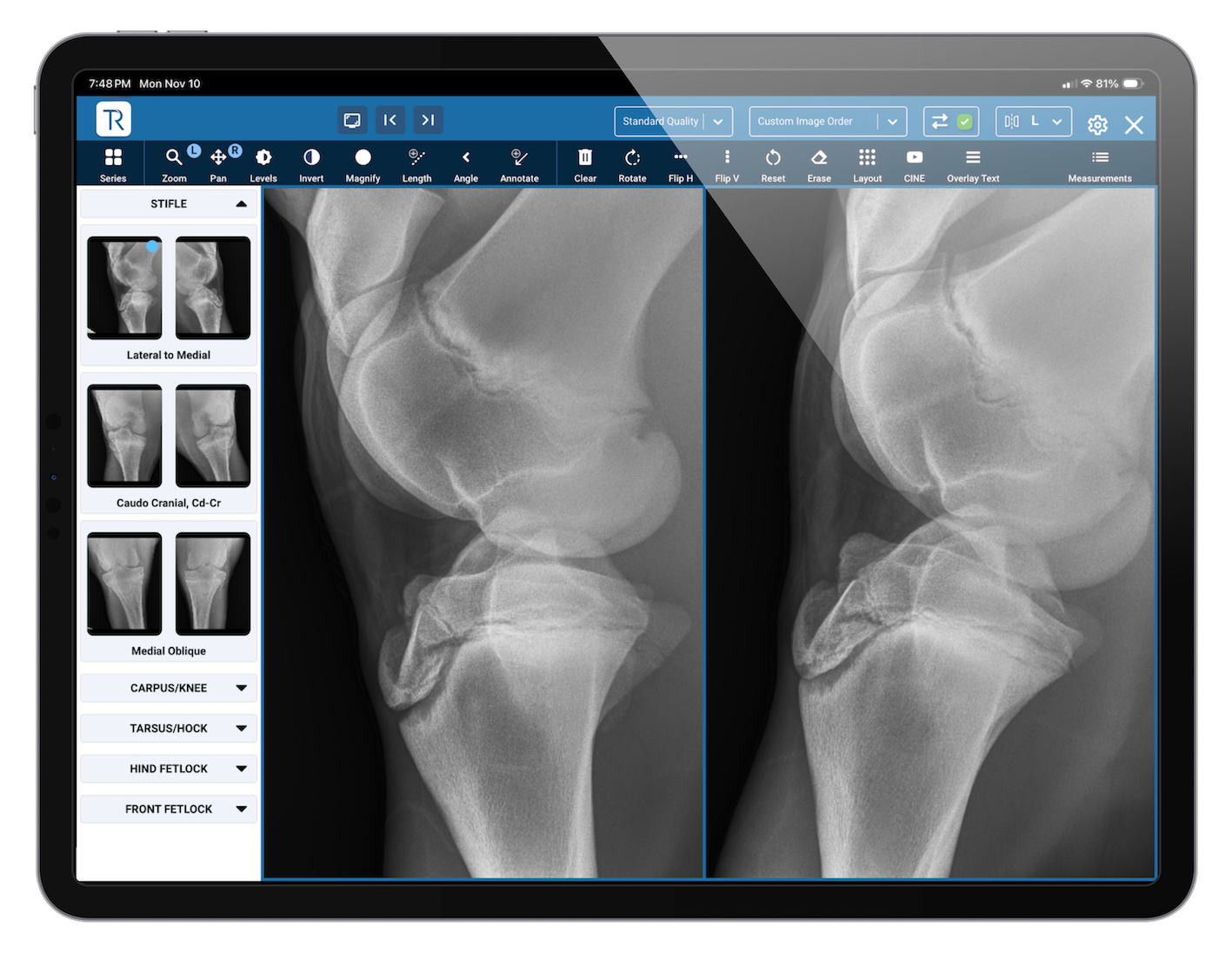 ThoroughRepository DICOM Viewer on iPad