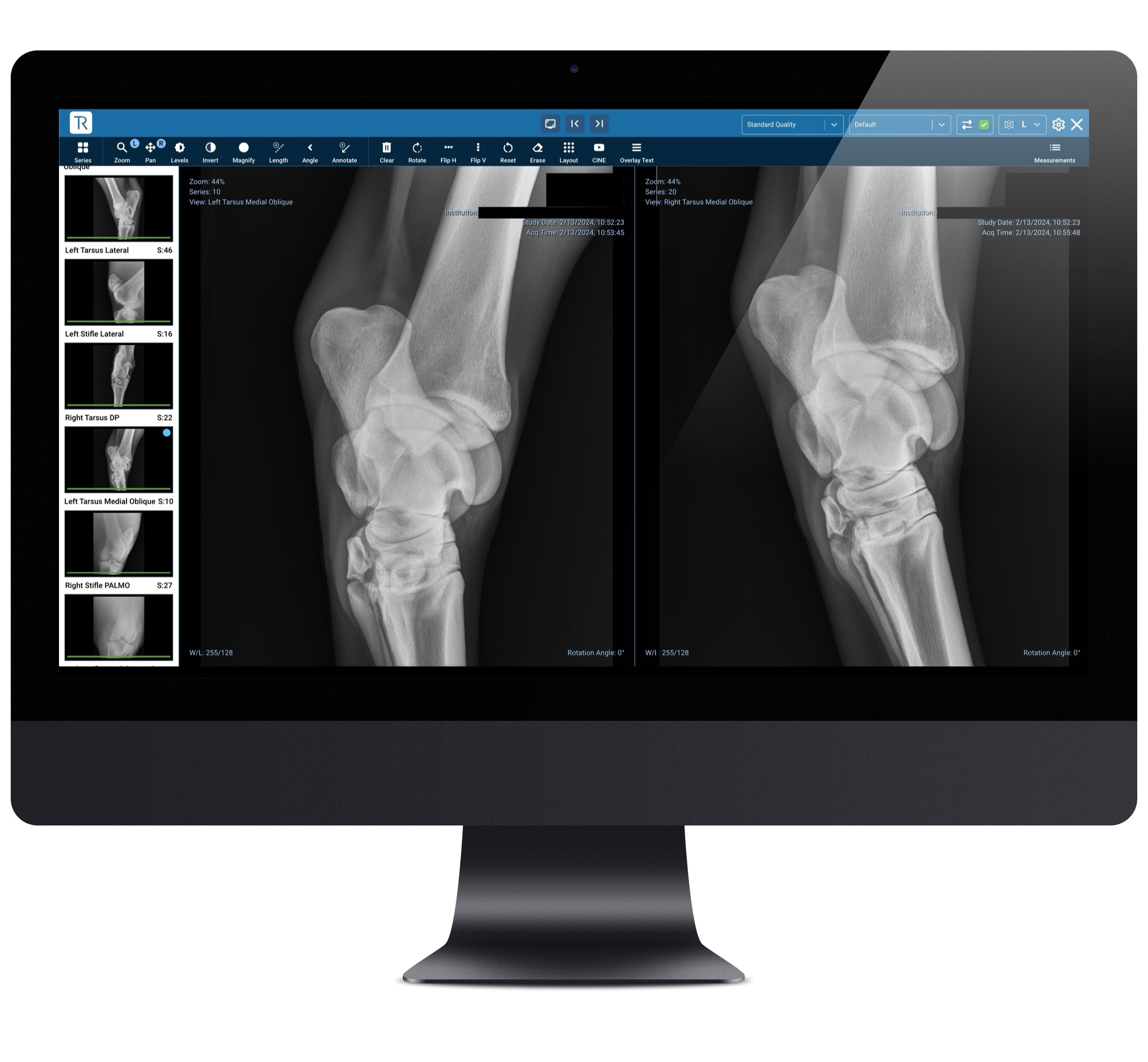 iMac - DICOM Viewer - Side by Side